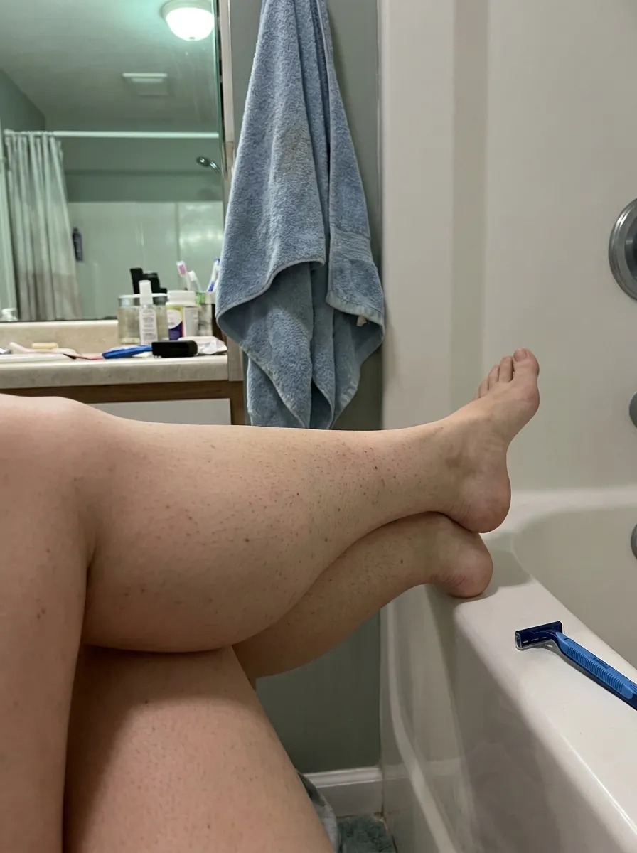 Before — stubble and razor bumps